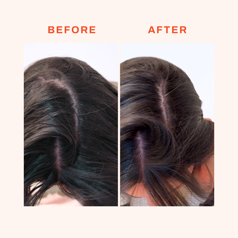 Detox Scalp Mask